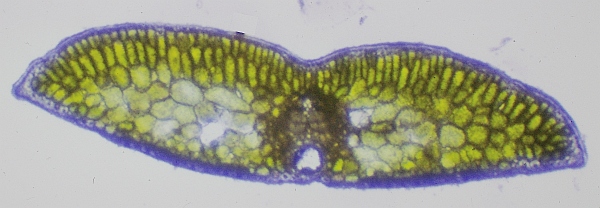 ツガの葉の断面